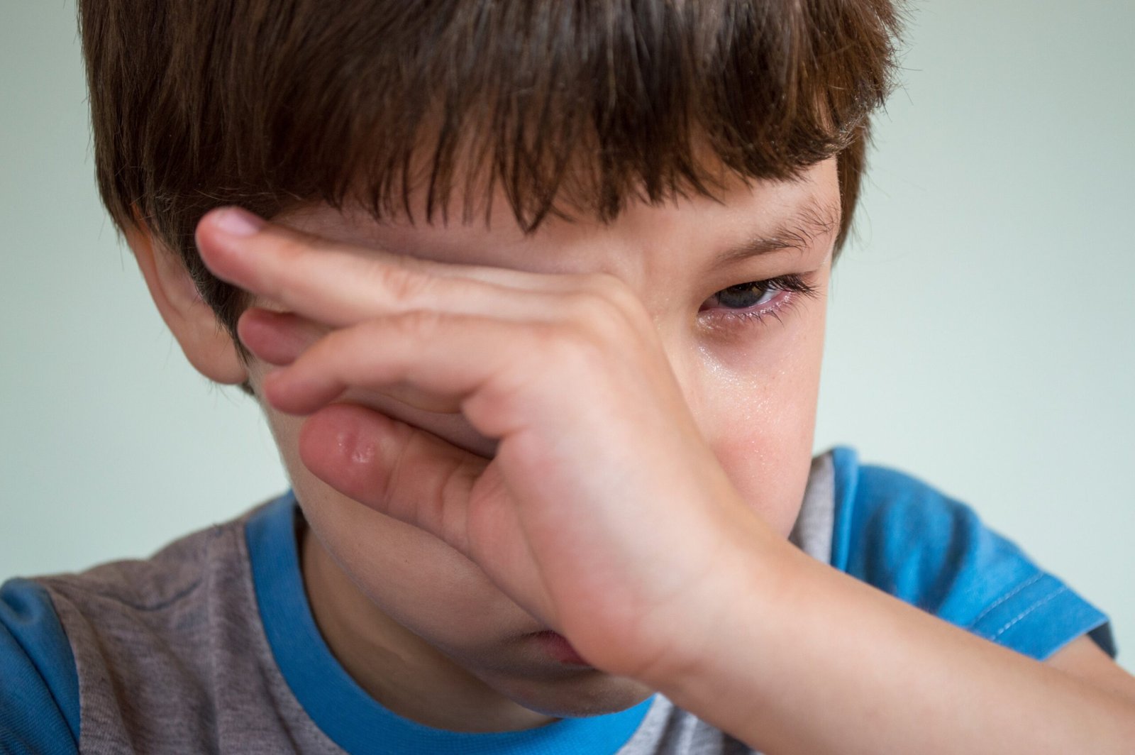 Read more about the article Understanding and Managing Your Child’s Pink Eye ‘Conjunctivitis’